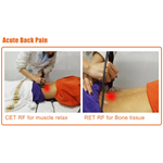 Tecar Therapy Physio Monopolar RF Resistive and Capacitive Machine Tecarterapia Profesional
